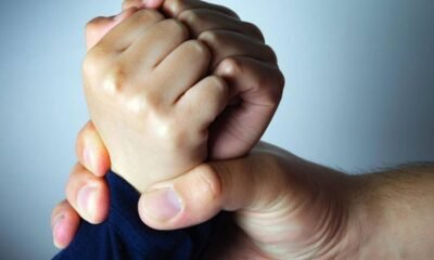 Le Destrozó El Rostro atacándola a Mordiscos