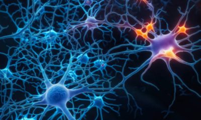 Laboratorio Trae A Colombia Pruebas Apobadas por la Fda para el Diagnóstico de Alzheimer