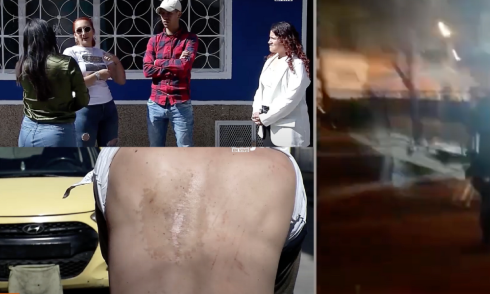Familia Denuncia Presunto Abuso Policial en Suba, Bogotá: Expertos analizan el Caso
