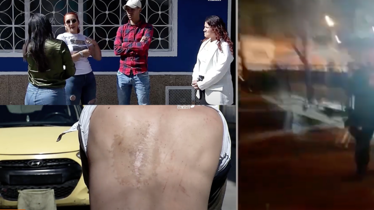 Familia Denuncia Presunto Abuso Policial en Suba, Bogotá: Expertos analizan el Caso