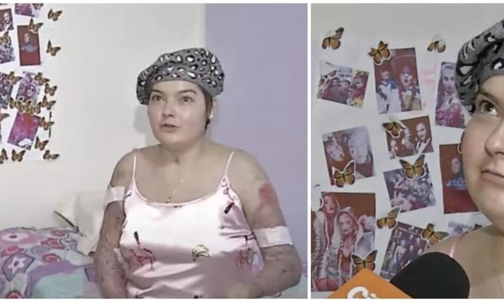 El Conmocedor Mensaje que le Dieron Los Médicos a Laura Villamil, La Batarina Que Sufrió Graves Quemaduras en Andrés Carne de Res: 'Eres Un Milagro'