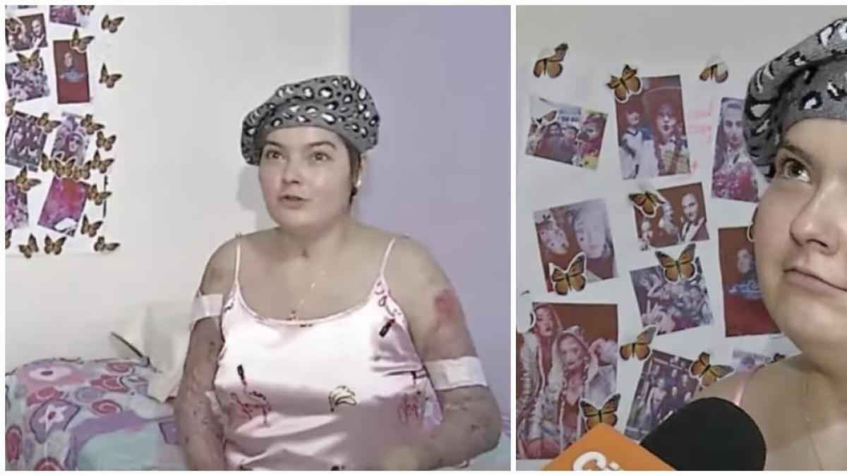 El Conmocedor Mensaje que le Dieron Los Médicos a Laura Villamil, La Batarina Que Sufrió Graves Quemaduras en Andrés Carne de Res: 'Eres Un Milagro'