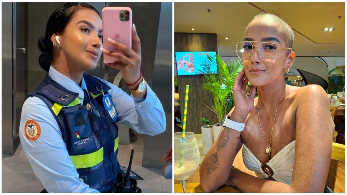 La Rara Enfirmedad Que Aqueja A Agente de Tránsito Que Hicieron Viral por video de Tiktok
