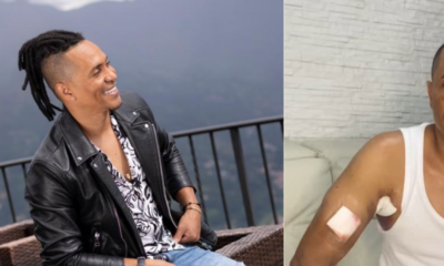 Hobró Yair Ortiz, Cantante Herido en Balacera en Barrio de Medellín: 'SE Presentó una riña'