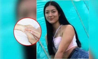 Joven Quedó Cuadripléjica Tras Recibir un Botellazo y Pide Eutanasia: 'Para mi no es Vida'