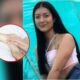 Joven Quedó Cuadripléjica Tras Recibir un Botellazo y Pide Eutanasia: 'Para mi no es Vida'