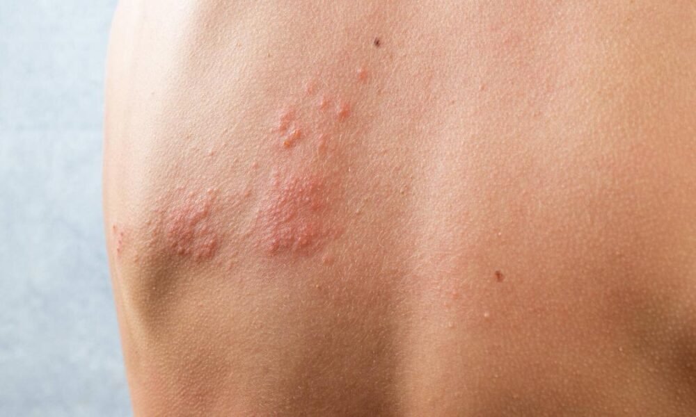 ¿Por qué Están Concientizando Sobre la Importia de la Vacuna en Bogutá?