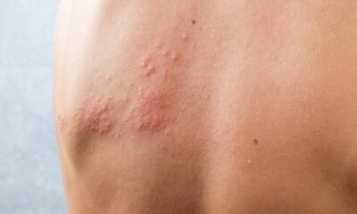 ¿Por qué Están Concientizando Sobre la Importia de la Vacuna en Bogutá?