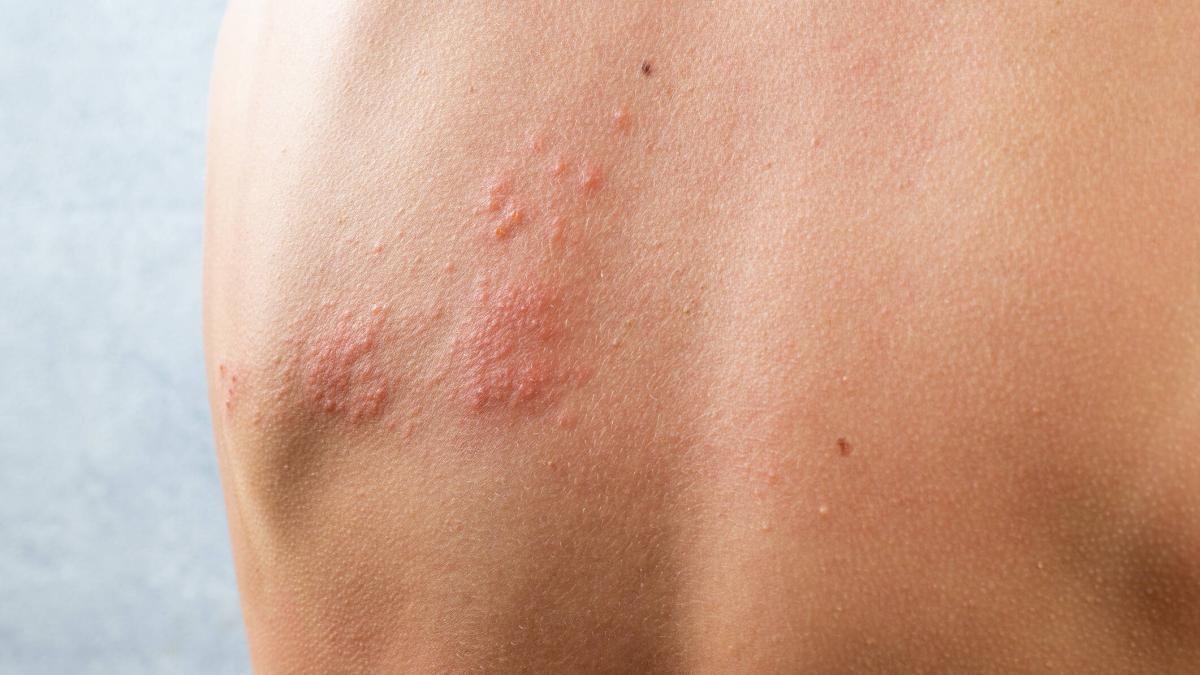 ¿Por qué Están Concientizando Sobre la Importia de la Vacuna en Bogutá?