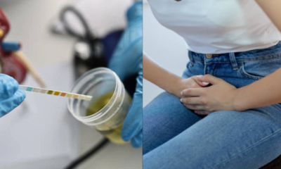 Joven de 15 Años Fue Atacada Con ácido Mientras Dormia en sucre