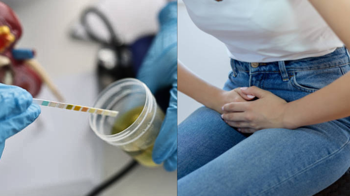 Joven de 15 Años Fue Atacada Con ácido Mientras Dormia en sucre