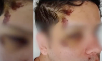 Joven Sufrió Violento Robo en Centro de Bogotá Cuando Iba A Tomar Transmilenio: Quedó Desorientado Por Los Golpes