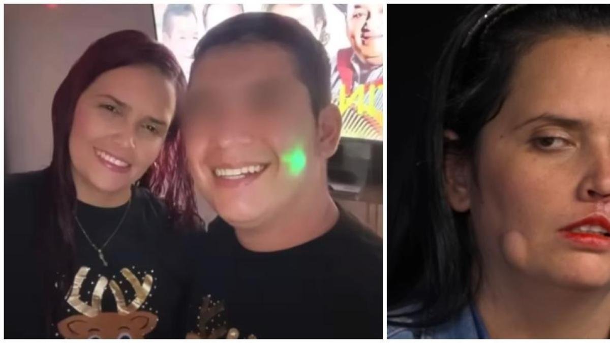'Yo Arrancó Todo El Labio Superior'