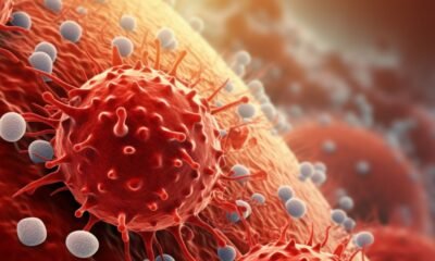 Cómo buscan impulsar las defensas del cuerpo contra el cáncer los expertos del MIT