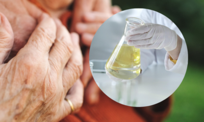 Joven de 23 Años Fue Quemado Con ácido por su abuela en sinceljo en medio de una fuerte disco