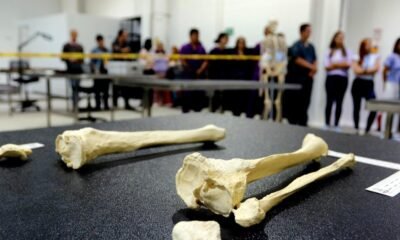 El Laboratorio Con El Que Agilizarán la Identificación de Víctimas del Conflma Armado