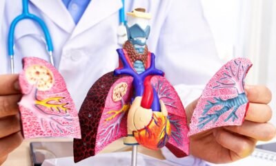 Reportan 111 Casos de tuberculosis en la Cárcel Modelo de Bucaramanga: ¿Cómo se está Controlando?