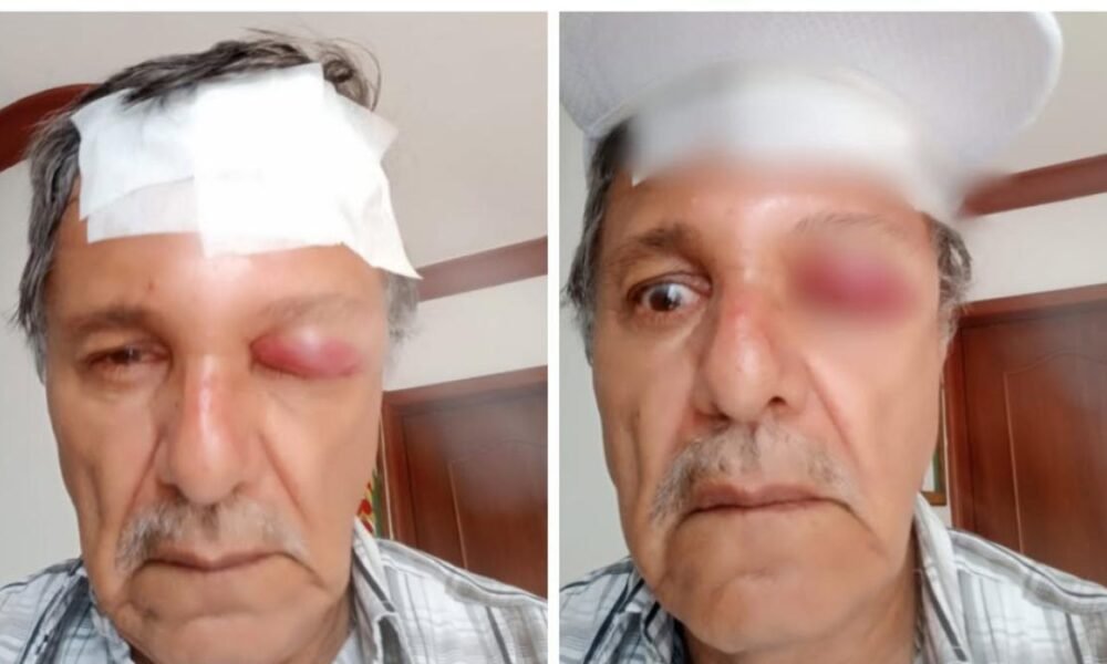 Así Va el Casar del Camarógrafo Agredido por Motociclista en Cali