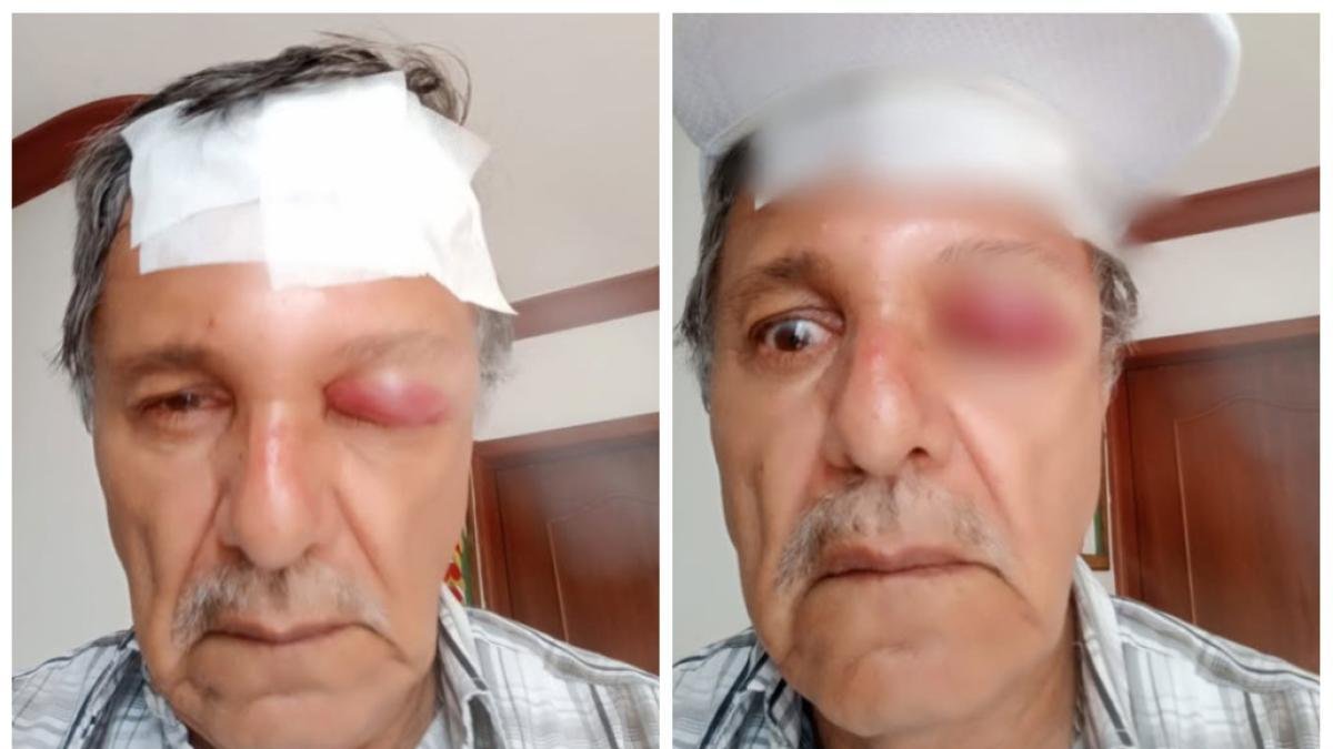 Así Va el Casar del Camarógrafo Agredido en Cali