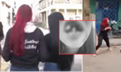 Una de Ellas perdió 4 dientes