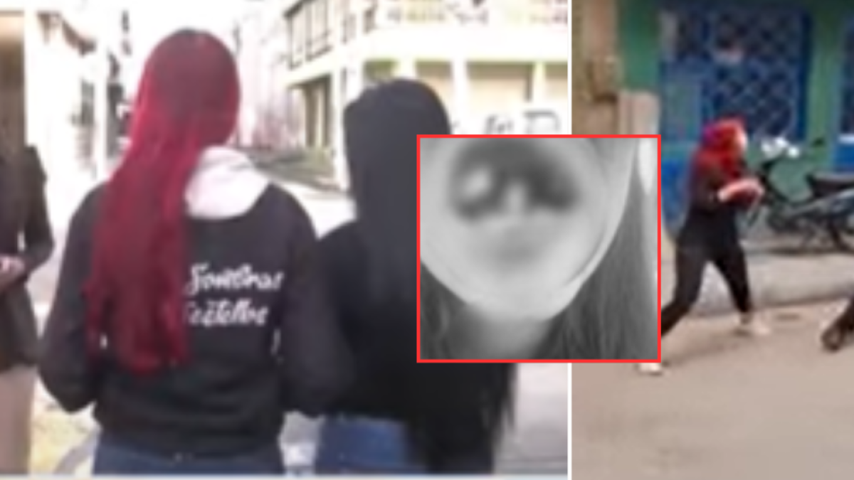 Una de Ellas perdió 4 dientes