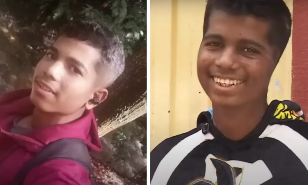 Joven Atacado Por Perros en Bogotá Narró Cómo Fue Agresión en la Que Perdió Sus Brazos: 'Sentía Cómo me Agararraban'