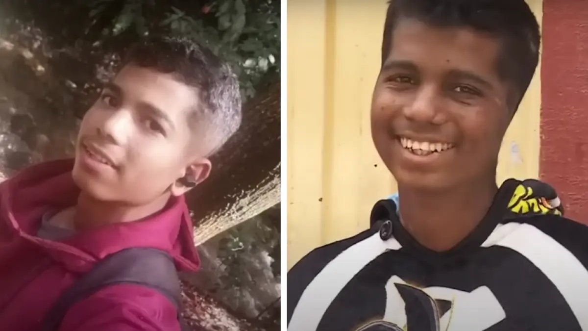 Joven Atacado Por Perros en Bogotá Narró Cómo Fue Agresión en la Que Perdió Sus Brazos: 'Sentía Cómo me Agararraban'