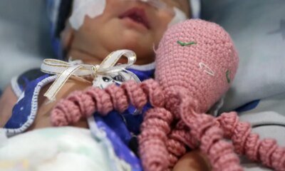 EL Hospital de Meissen, Los Bebés de la Uci Duermen Con Peluches de Pulpos