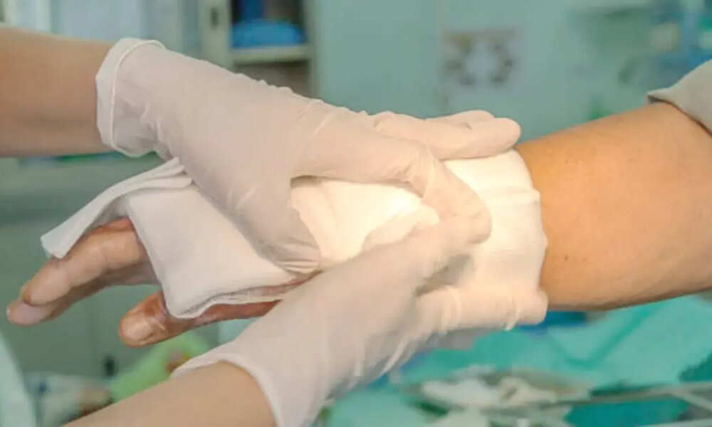 Mujer le Prendió Fuego A Su Esposo Cuando Estaba Con UNA Joven en UNA FINCA DE GAMARRA, CESAR: ESTO ES LO QUE SE SABE