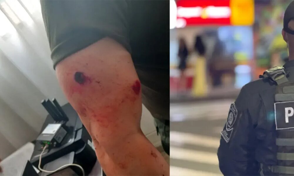 Comandante Operativo de Policía Antioquia Resultado de Herido en una asonada