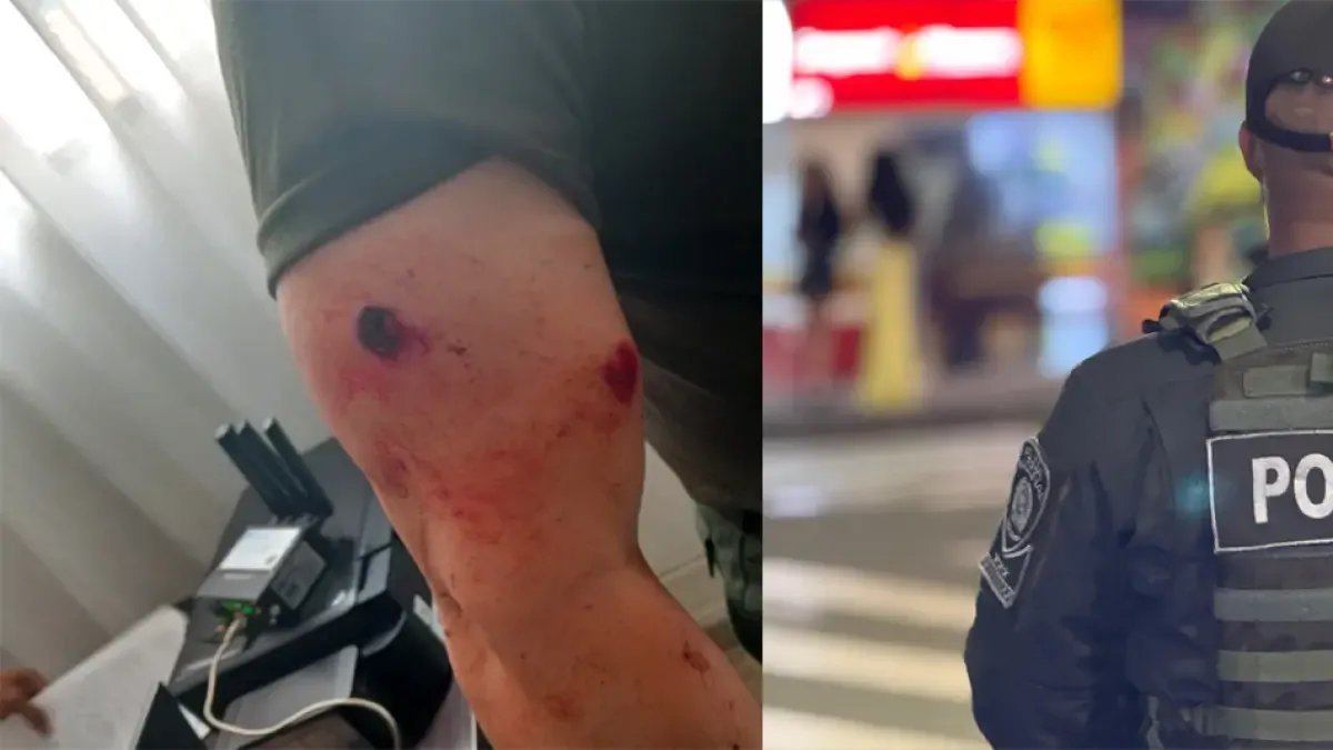 Comandante Operativo de Policía Antioquia Resultado de Herido en una asonada