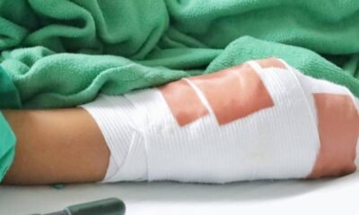 Nuevo detalla del Caso de la Habitante de Calle A Quien le Prendieron Fuego Tras una Discusión en Medellín: 'Le Habría Reglamado'