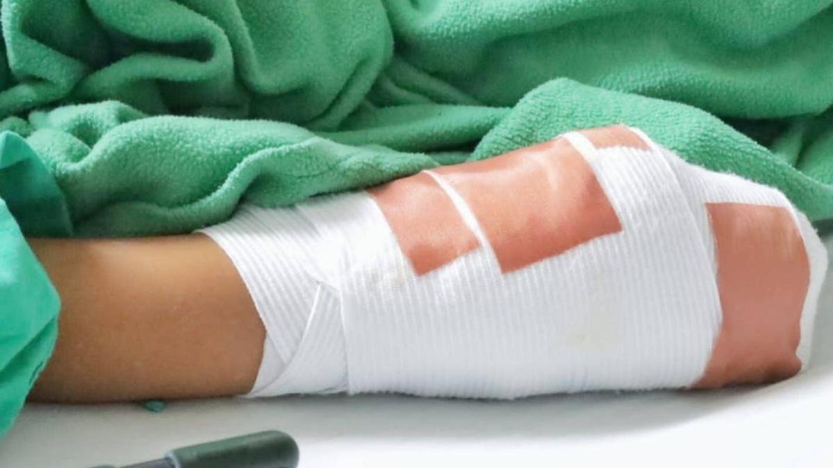 Nuevo Detalla del Caso de la Habitante de Calle A Quien Le Rociaron Gasolina y Le Prendieron FUEGO EN MEDELLÍN