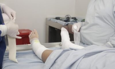 Personería lanza alerta por quemados por bioetanol en bogotá