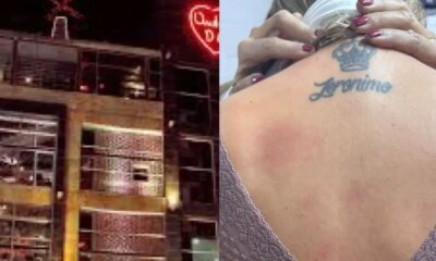 Noche de Terror en Andrés DC: Chispas de Una Máquina Dejaron Quemaduras en Clientes