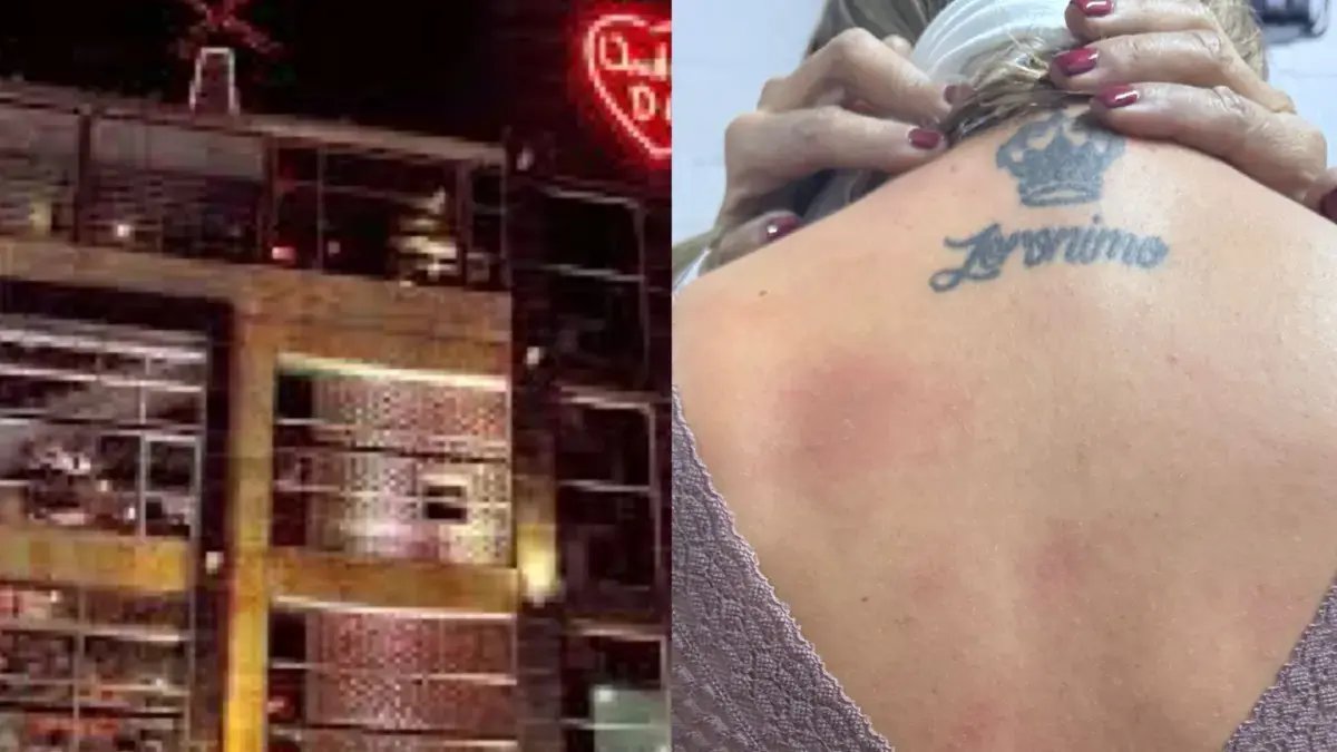 Noche de Terror en Andrés DC: Chispas de Una Máquina Dejaron Quemaduras en Clientes