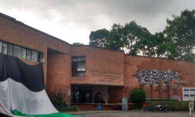 Estas hijo Lasesiones que sufrió el hombre que Accionó Explosivo