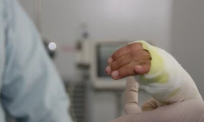 En Menos de dos Años, 34 Personas Han resultado Con Quemaduras Graves Por el Uso de Chimeneas y Califactores con bioetanol en bogotá