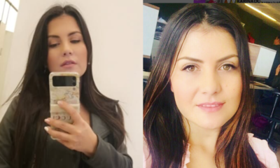 Karina Rincón, la mujer atacada con un martillo por su expareja, recibió una prótesis d