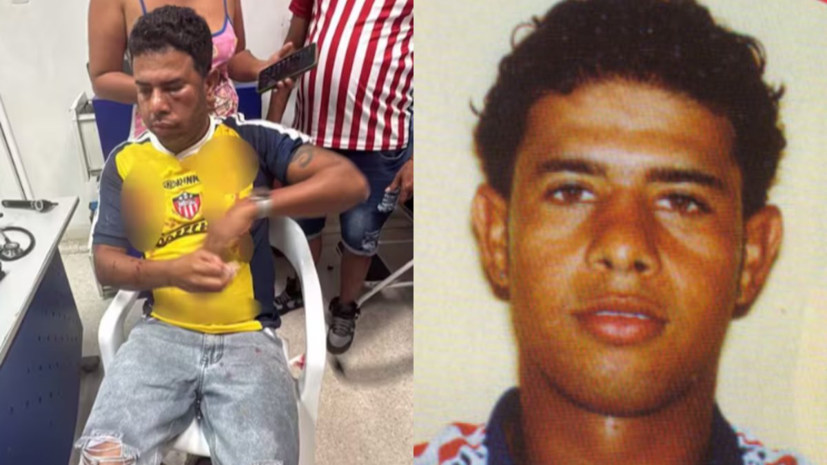 Daniel Machacón, exjugador del Junior, se recupera tras resultar herido en una riña en Suan