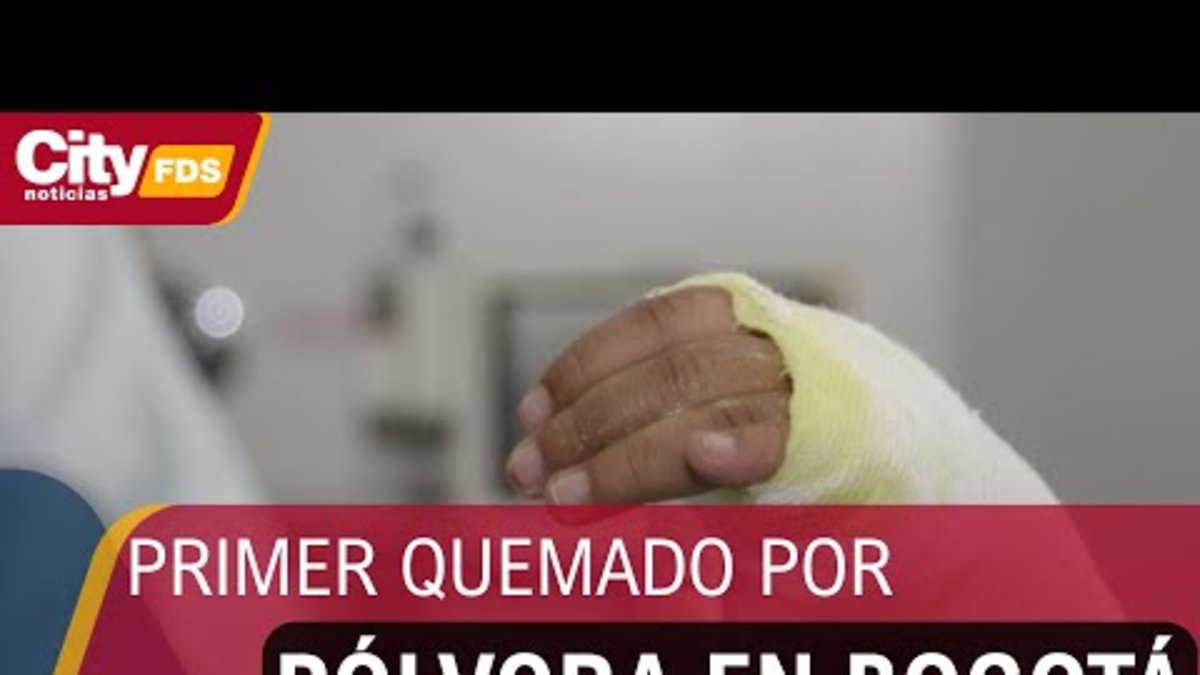 mujer de 33 años sufrió lesiones en el rostro