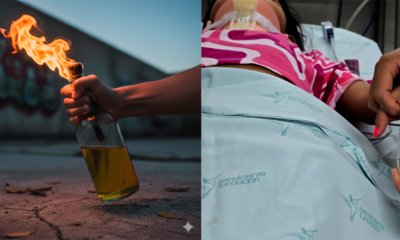 de 4 años murió tras permanecer hospitalizado por graves quemaduras cuando le tiraron una botella prendida niño con gasolina