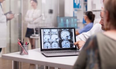 Colombia logró avances en atención del accidente cerebrovascular, pero persiste la brecha en el acceso temprano