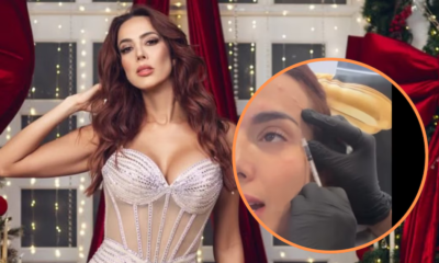Violeta Bergonzi mostró el procedimiento de botox en su rostro y generó debate en redes: “Me duele verme frente al espejo”