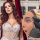 Violeta Bergonzi mostró el procedimiento de botox en su rostro y generó debate en redes: “Me duele verme frente al espejo”
