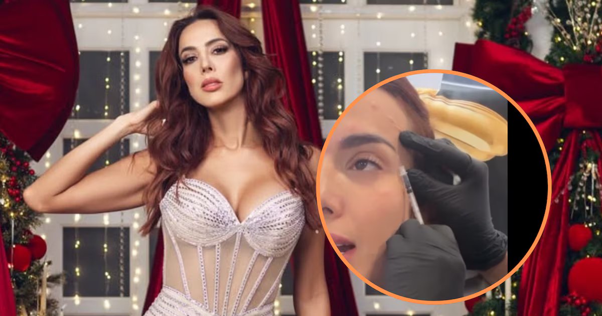 Violeta Bergonzi mostró el procedimiento de botox en su rostro y generó debate en redes: “Me duele verme frente al espejo”
