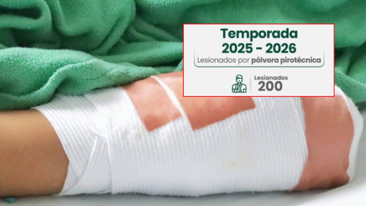 Antioquia llegó a los 200 quemados por pólvora: es la cifra más alta de lesionados en el departamento en la última década: Medellín registra 79 casos