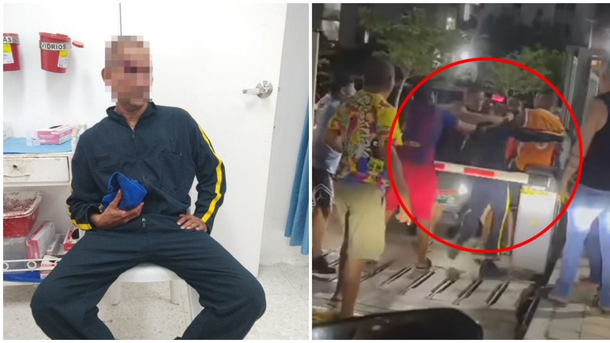 'Fue atacado de manera salvaje'