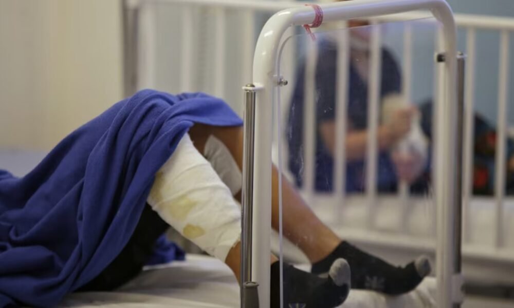 Un niño de 8 años está en la UCI tras sufrir graves quemaduras en el 95% de su cuerpo en Soledad: familiares intentaban quemar gusanos