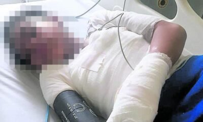 agresor de niña atacada en Suba tenía dos condenas vigentes y orden de captura y hoy está privado de la libertad